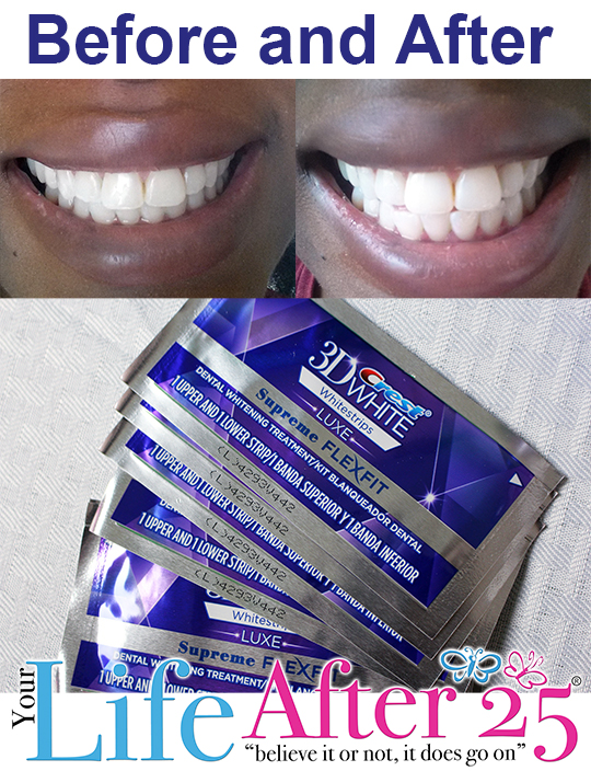 Before and After Crest Whitening strips