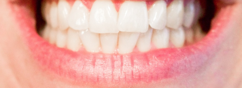 Crooked Teeth: Is Invisalign The Right Answer For You?