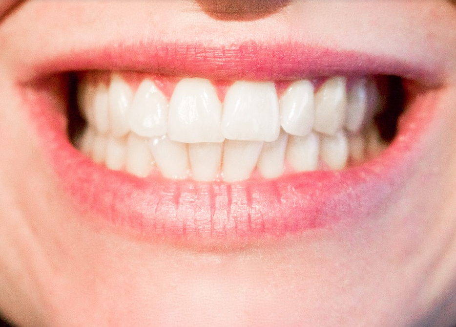Crooked Teeth: Is Invisalign The Right Answer For You?