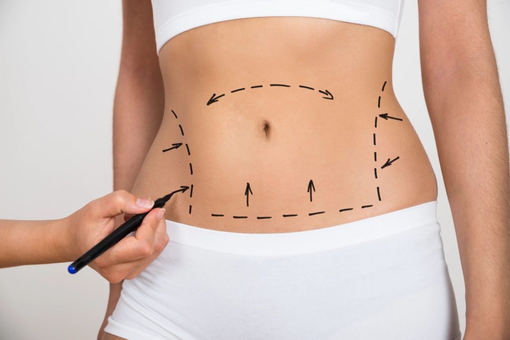 Choosing to Change: Being Highly Confident About Your Cosmetic Surgery