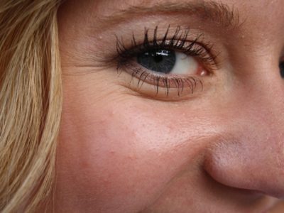 5 Types of Facial Wrinkles And How To Prevent Them