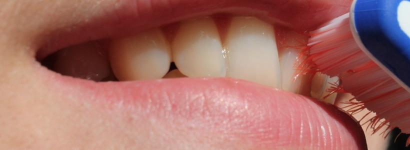 Your Teeth: the Bad and the Good Guys