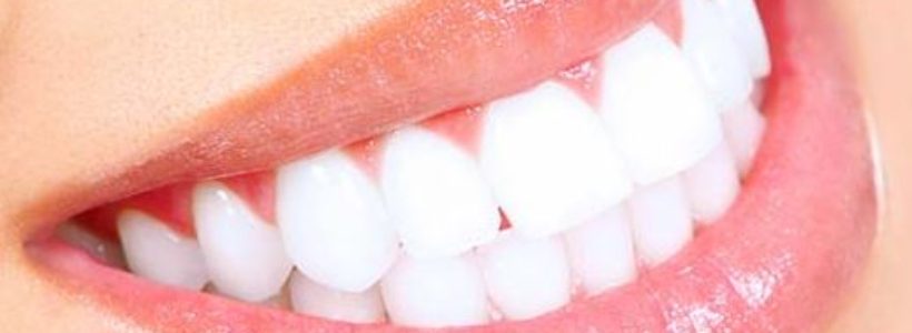 Cosmetic Dental: How to Achieve that Bright, Beautiful Smile You Have Always Wanted